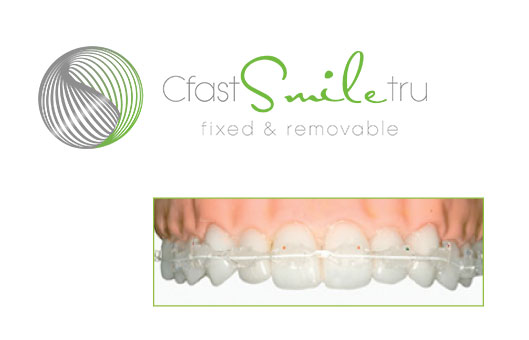 CFast Clear Braces Leicester
